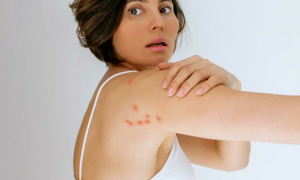 Why Choose Professional Heat Treatment for Bed Bugs?